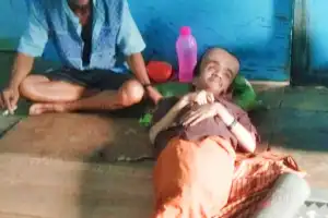 Pilu Abdullah, 21 Tahun Idap Hidrosefalus dan Hanya Terbaring di Kasur