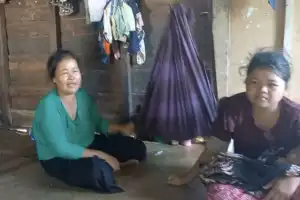 Tinggal di Rumah Tak Layak Huni, Bayi Penderita Gizi Buruk di Aceh Singkil Butuh Perhatian