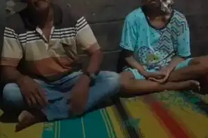 Tolong! Asna Warga Agara 8 Tahun Idap Kanker Kepala, Butuh Biaya Berobat