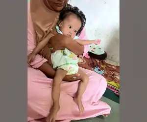 Cahaya Balita Bocor Jantung di Aceh Barat Berharap Bantuan Dermawan