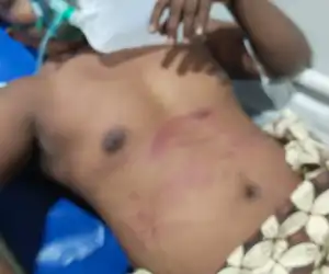 Lagi, Seorang Warga Bener Meriah Diinjak Gajah Liar