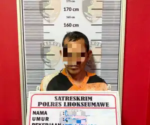 Ayah Siram Anak Tiri Pakai Air Keras Akhirnya Ditangkap, Ini Motif Pelaku